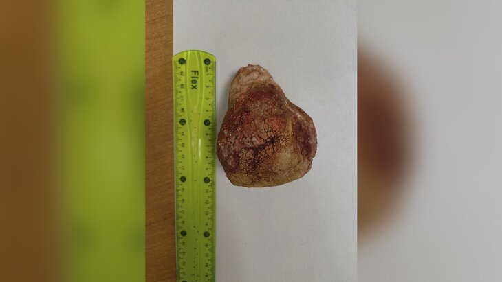 ������������ ����� ������� �� �������� ������ 72-������� �������� 10-������������� ������