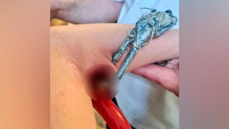 ����� � ����������� ������ ��������, � �������� � ���� ������� ������������� �������